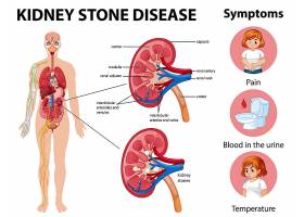 EPS矢量素材下载-肾结石疾病和症状信息